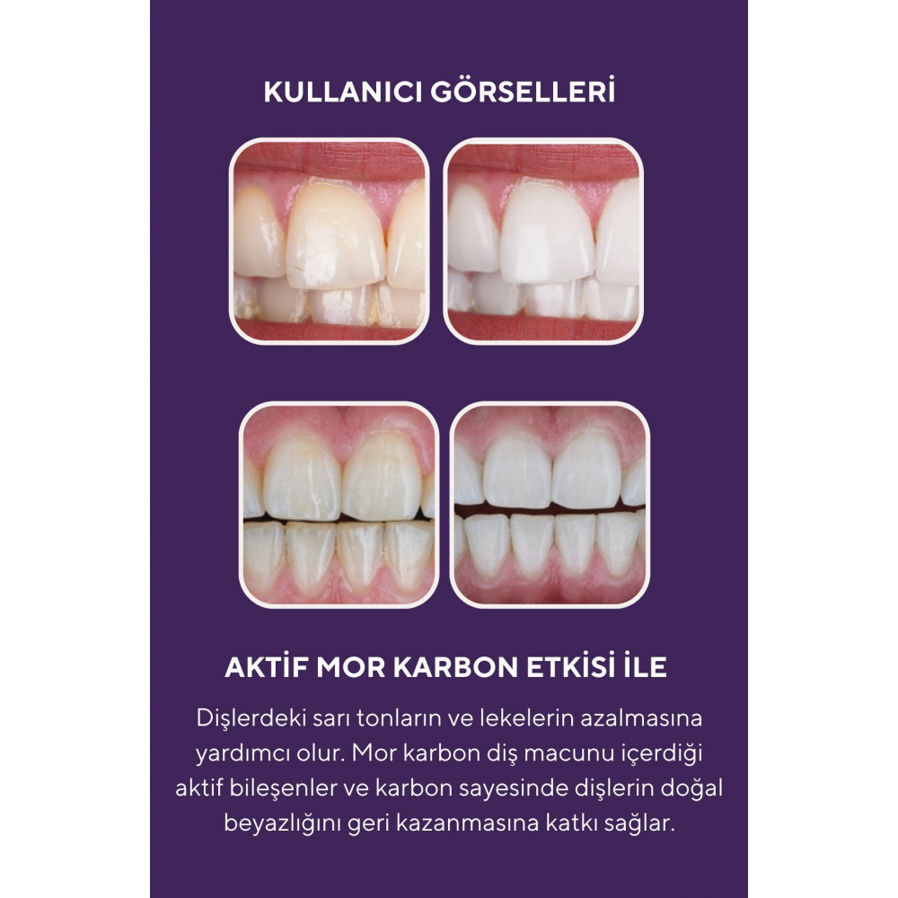 Mor Aktif Karbon Diş Beyazlatma Seti (Mor Karbon Diş Macunu 75 Gr + Mor Karbon Diş Tozu 50 Gr)