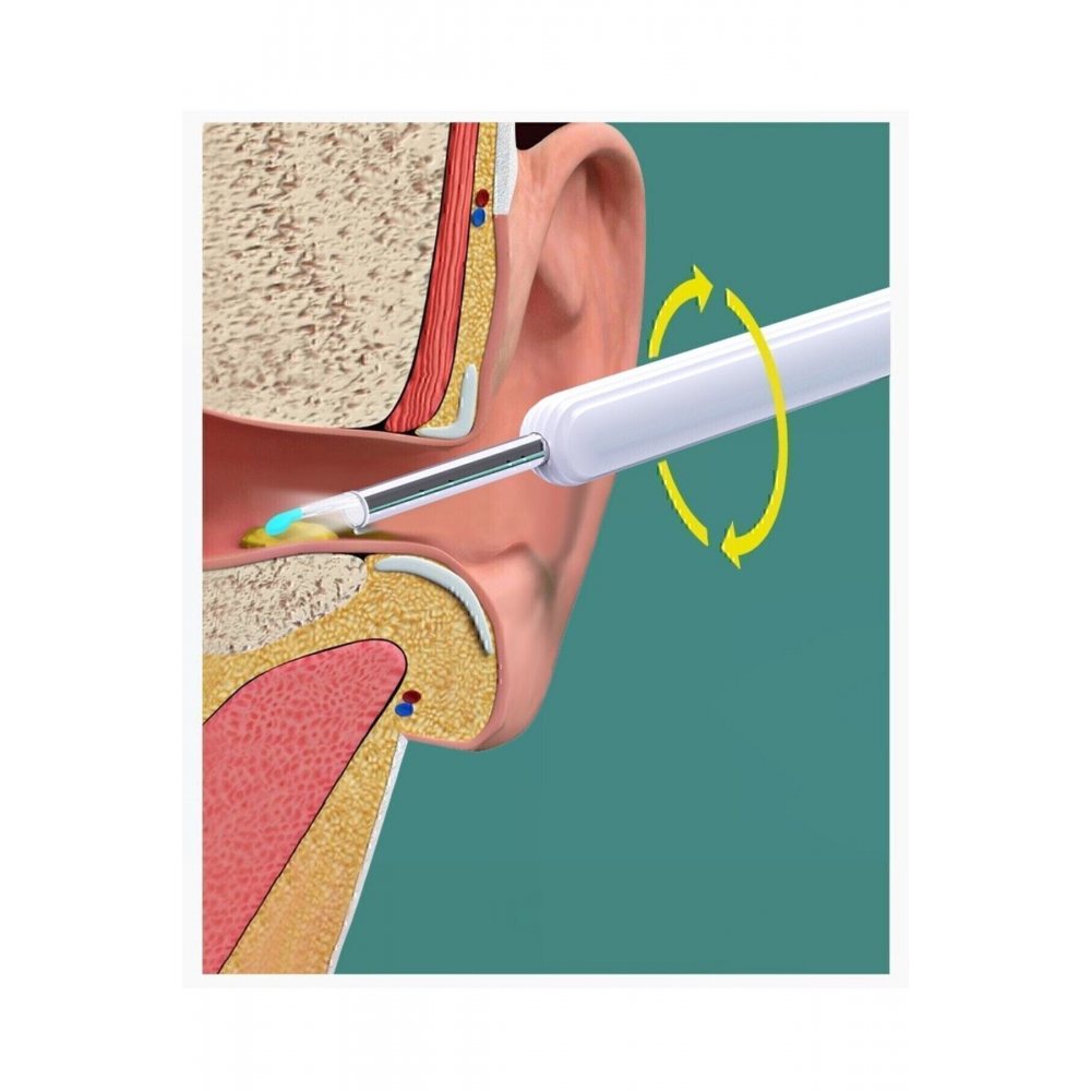 Kameralı Endoskopik Kulak Temizleme Cihazı - Yumuşak Silikon Uçlu Tasarım