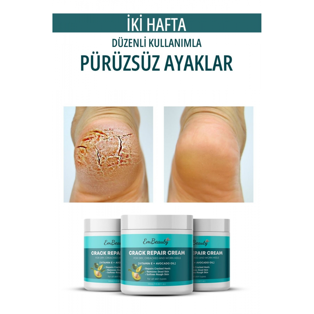 Ayak & Topuk Beyazlatıcı Etkili Krem 150 ML