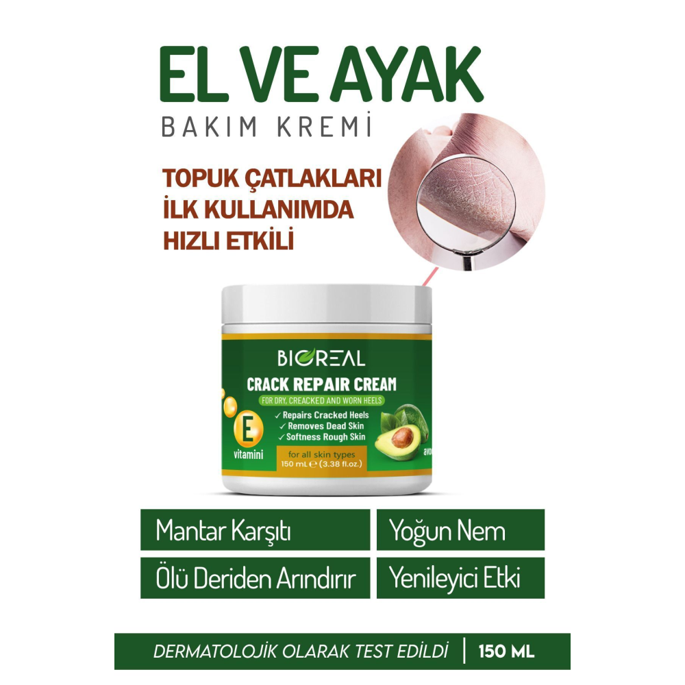 Yumuşatıcı Ayak Bakım Kremi - Mantar Tırnak Topuk Çatlaklarına Üstün Bakım 150 Ml
