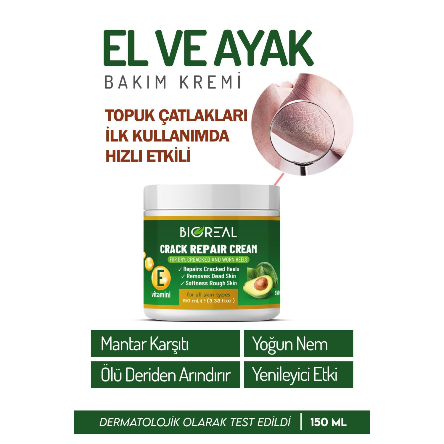 Yumuşatıcı Ayak Bakım Kremi - Mantar Tırnak Topuk Çatlaklarına Üstün Bakım 150 Ml