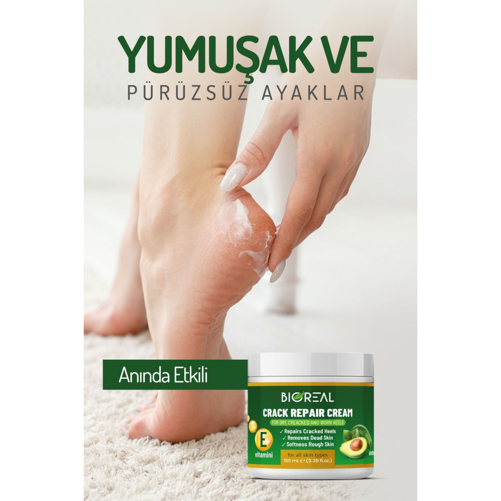 Yumuşatıcı Ayak Bakım Kremi - Mantar Tırnak Topuk Çatlaklarına Üstün Bakım 150 Ml