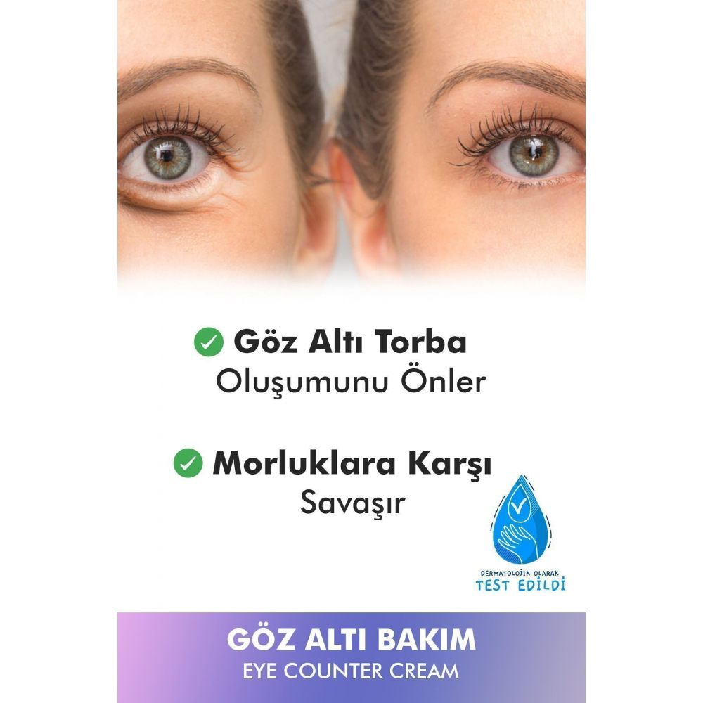 Göz Altı Torba Ve Morluk & Koyu Halka Karşıtı Yoğun Nemlendirici Ile Göz Altı Aydınlatıcı Krem 30ml