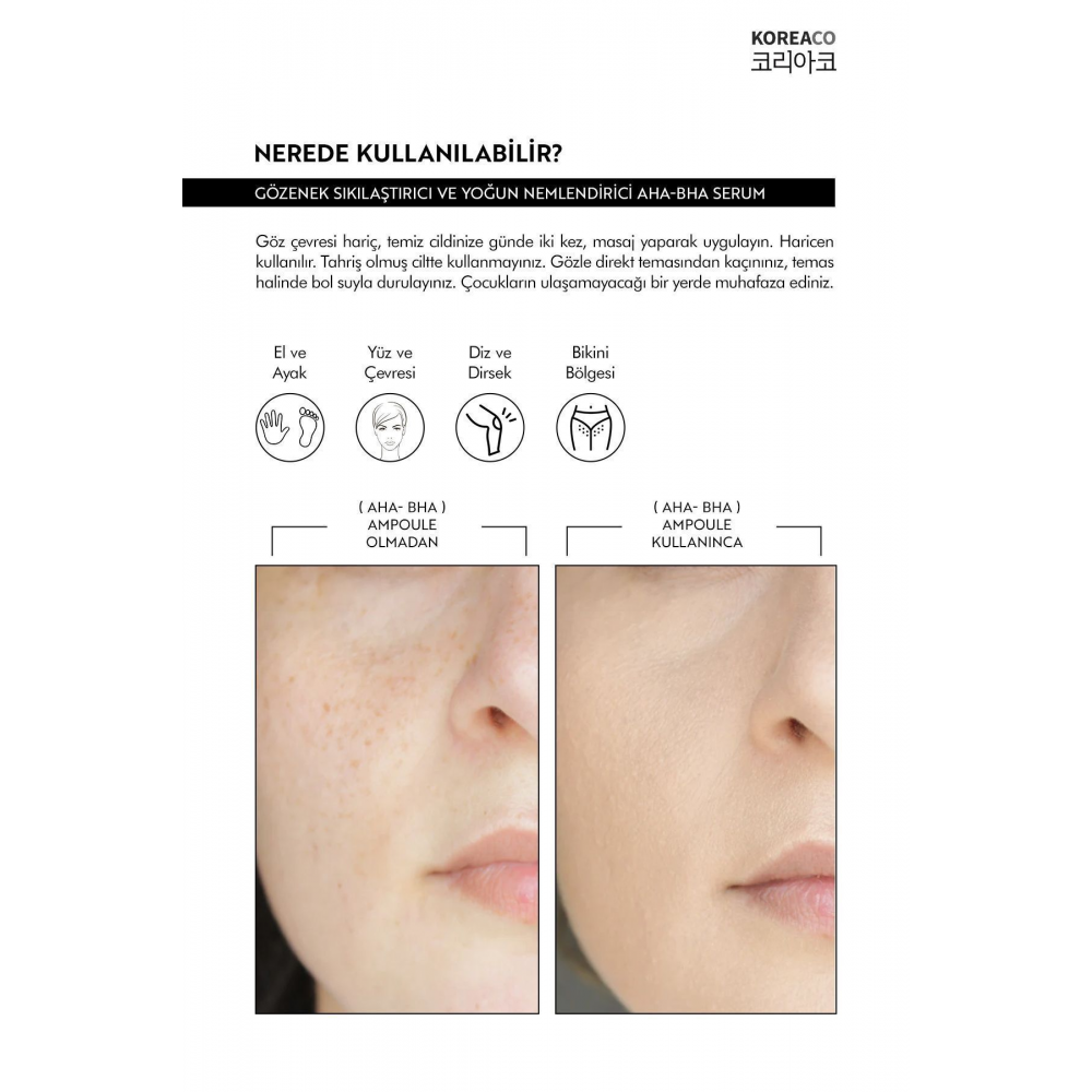 Aha & Bha Canlandırıcı & Gözenek Sıkılaştırıcı Ve Nemlendirici (AHA%10-BHA%2) Ampoule