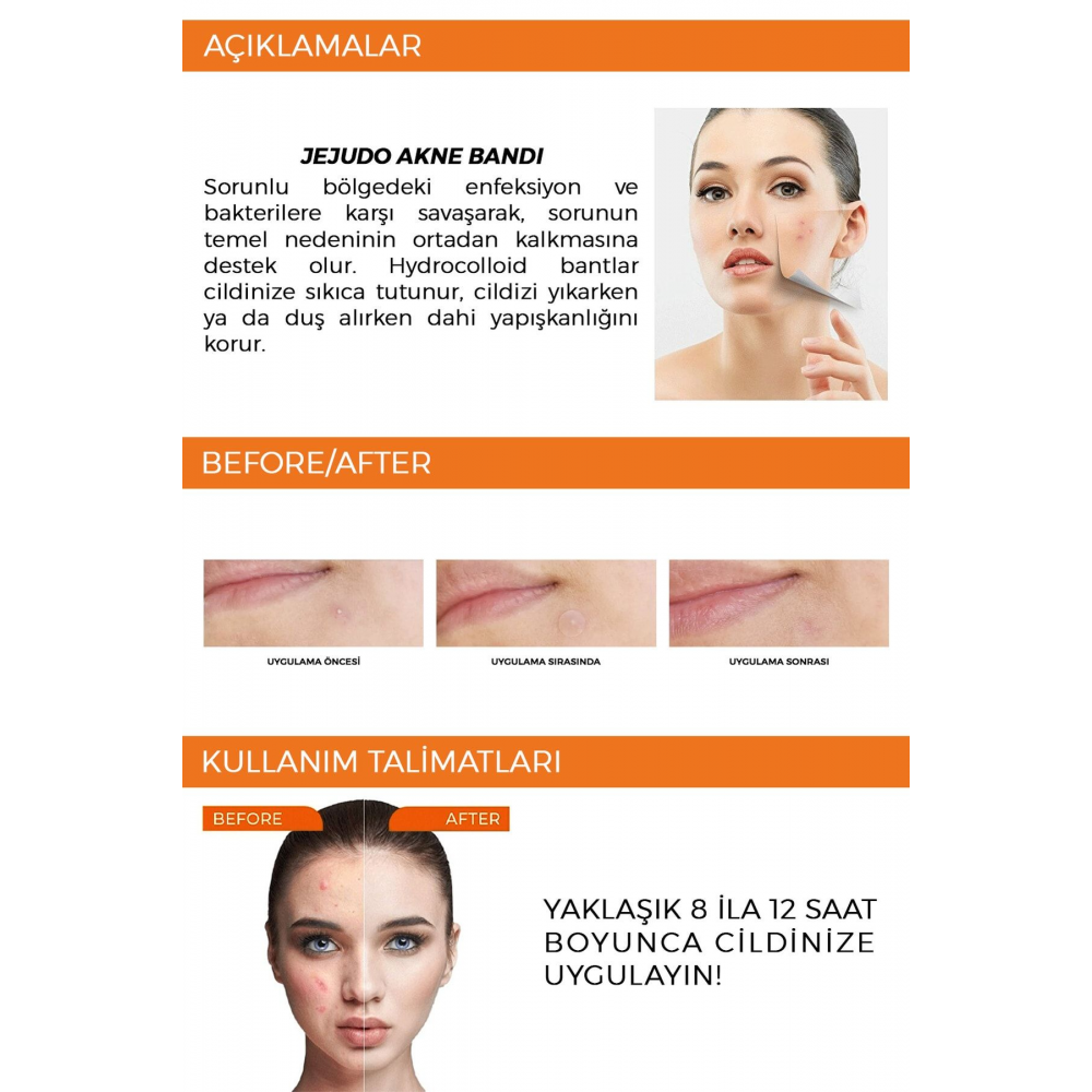 Ceuticals Original Pimple Patch 2x36 Patch Akne Ve Sivilce Bandı