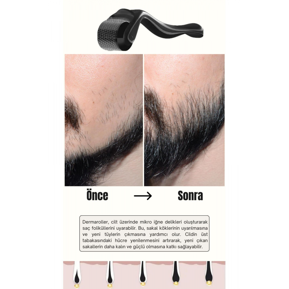 Titanyum Uçlu 540 İğneli Saç Sakal Çıkarma Ve Cilt Bakım Dermarolleri Masaj Aleti 1 mm