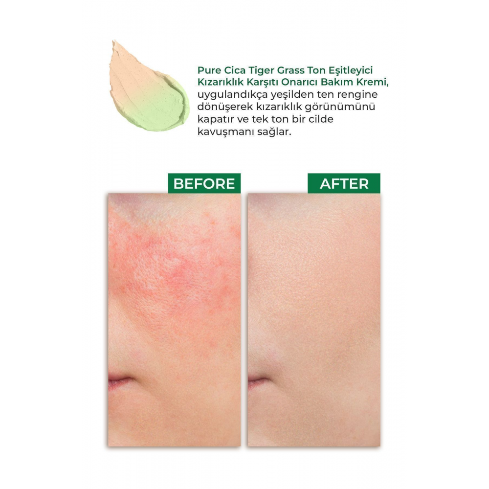 Pure Cica Tiger Grass Ton Eşitleyici Yoğun Onarıcı Yatıştırıcı Kızarıklık Karşıtı Yüz Kremi 15 ml