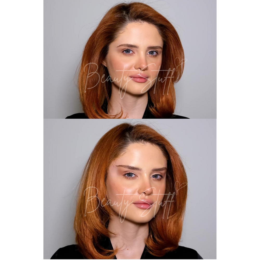 Kahverengi Lastikli Lift 'Em Up Yüz & Göz Germe Bantları (20'li paket) (Made in USA)