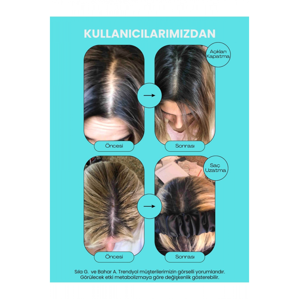 Ql Hair Vitamin Complex 60 Tablet Biotin Keratin Selenyum Çinko Folik Asit Saç Dökülmesi Vitamini