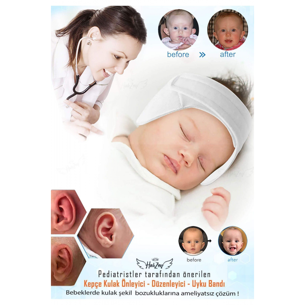 Bebek Kepçe Kulak Bandı / Kepçe Kulak Önleyici Ayarlanabilir Cırtları sayesinde 0- 2 Yaş arası uygun