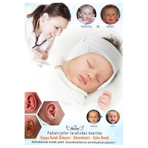 Bebek Kepçe Kulak Bandı / Kepçe Kulak Önleyici Ayarlanabilir Cırtları sayesinde 0- 2 Yaş arası uygun