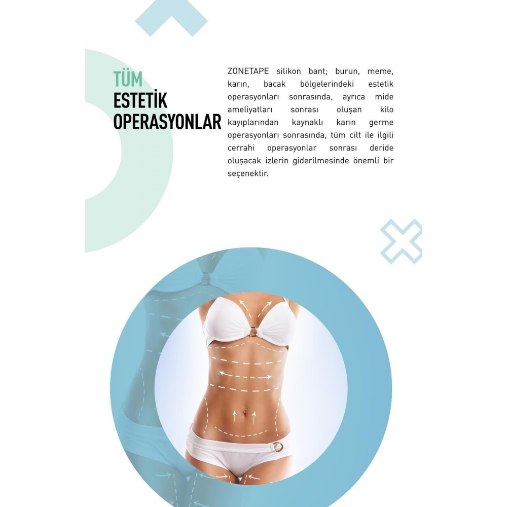 Soft Silikon Bant-estetik Yara Izi -sezaryen-yanık-ben Aldırma