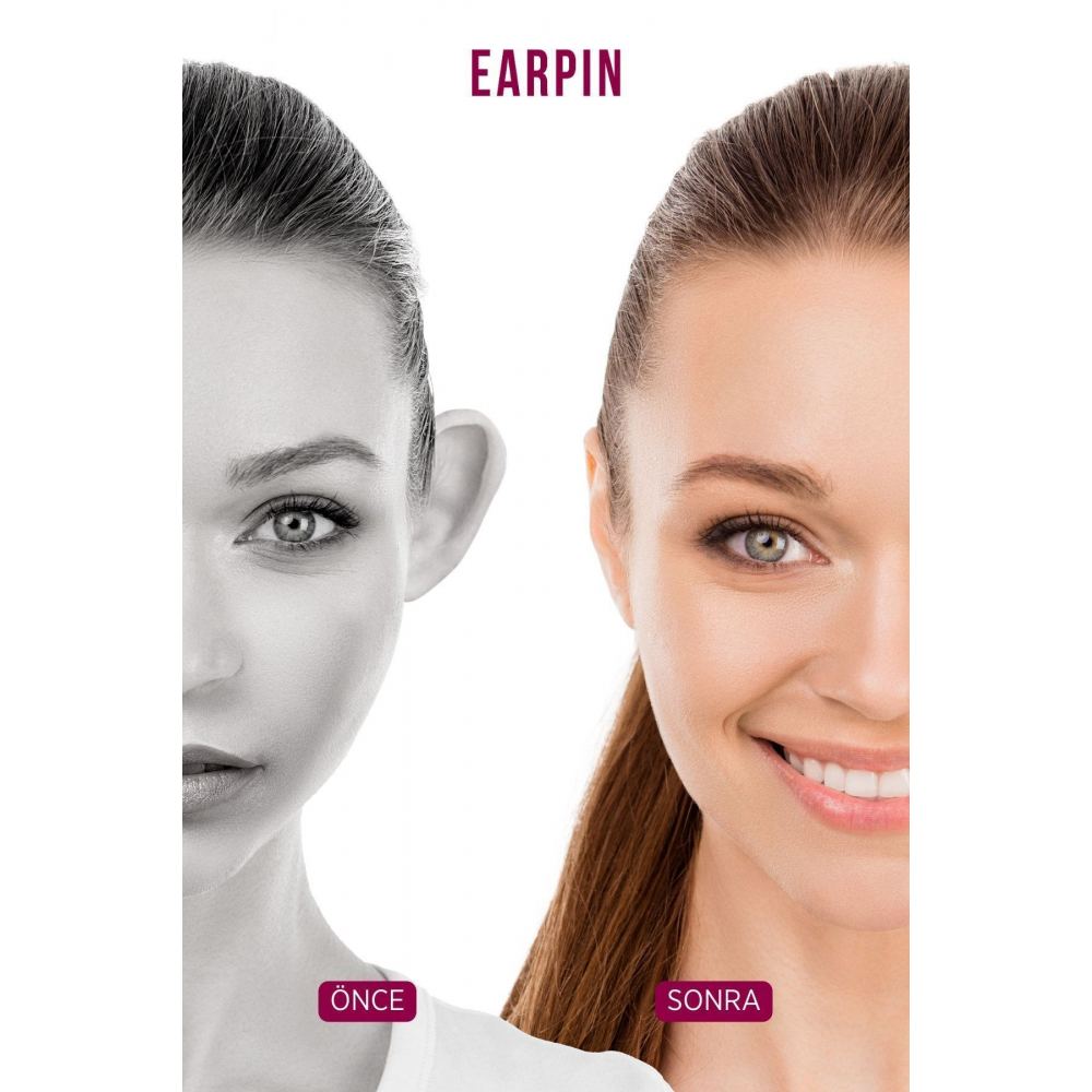 Earpin Kepçe Kulak Düzeltici