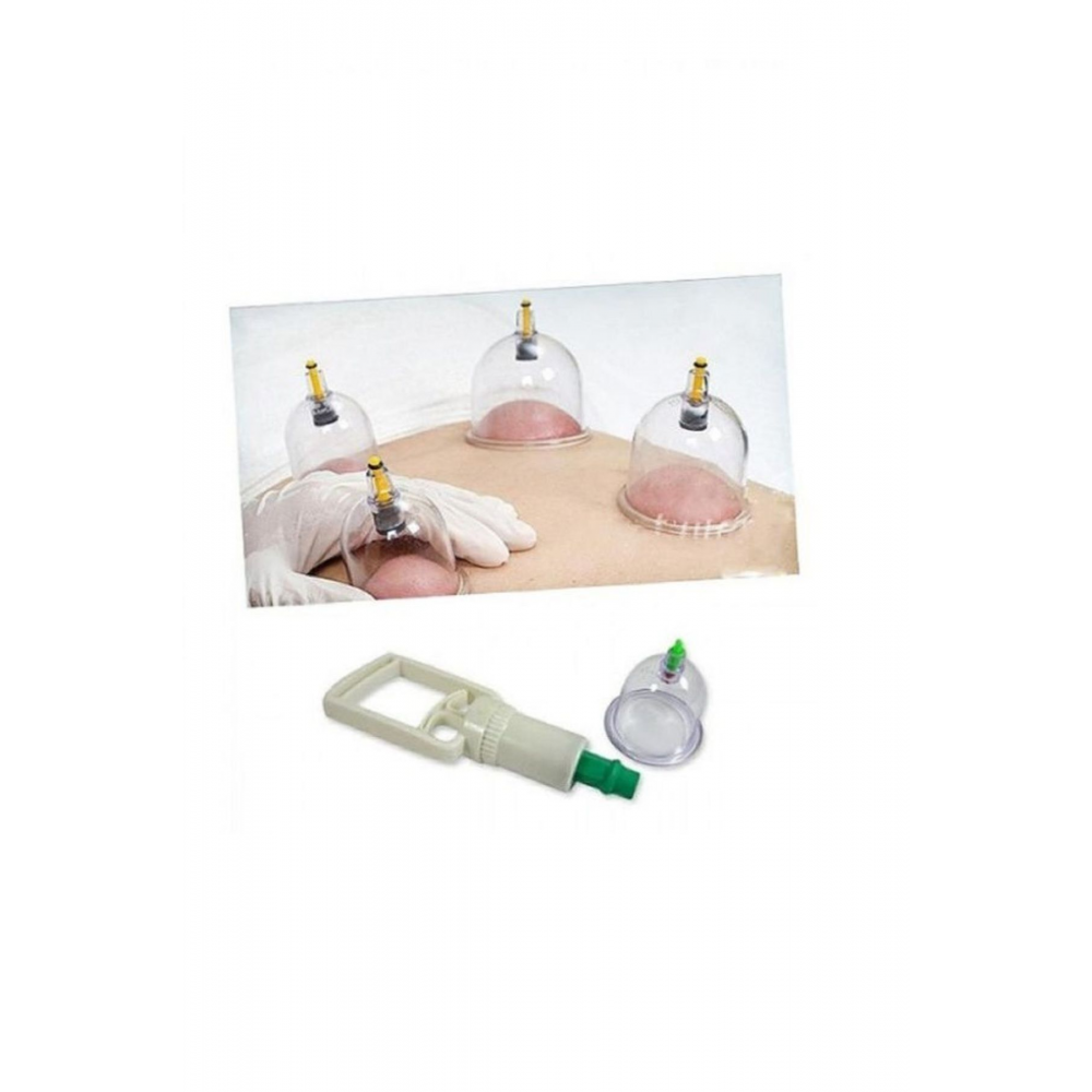 27'li Canlandırıcı Selülit Ve Çatlak Giderici Kupa Çekme Vakumlu Masaj Aleti - Hacamat Seti