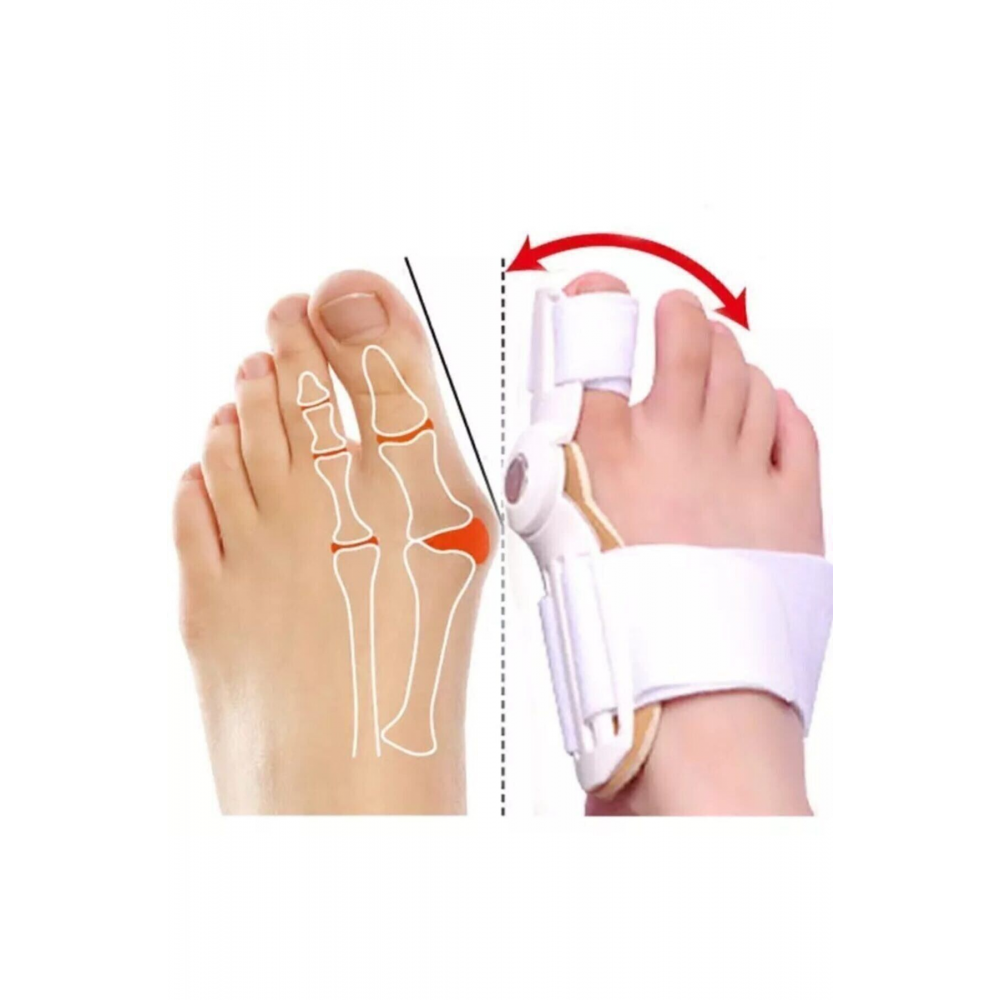 Baş Parmak Kemik Düzeltici - Ayak Parmak Düzeltici