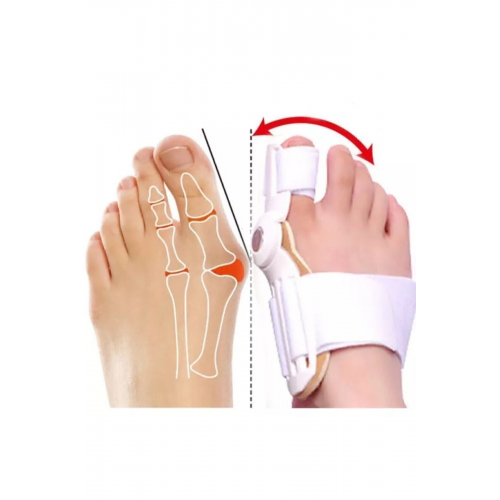 Baş Parmak Kemik Düzeltici - Ayak Parmak Düzeltici
