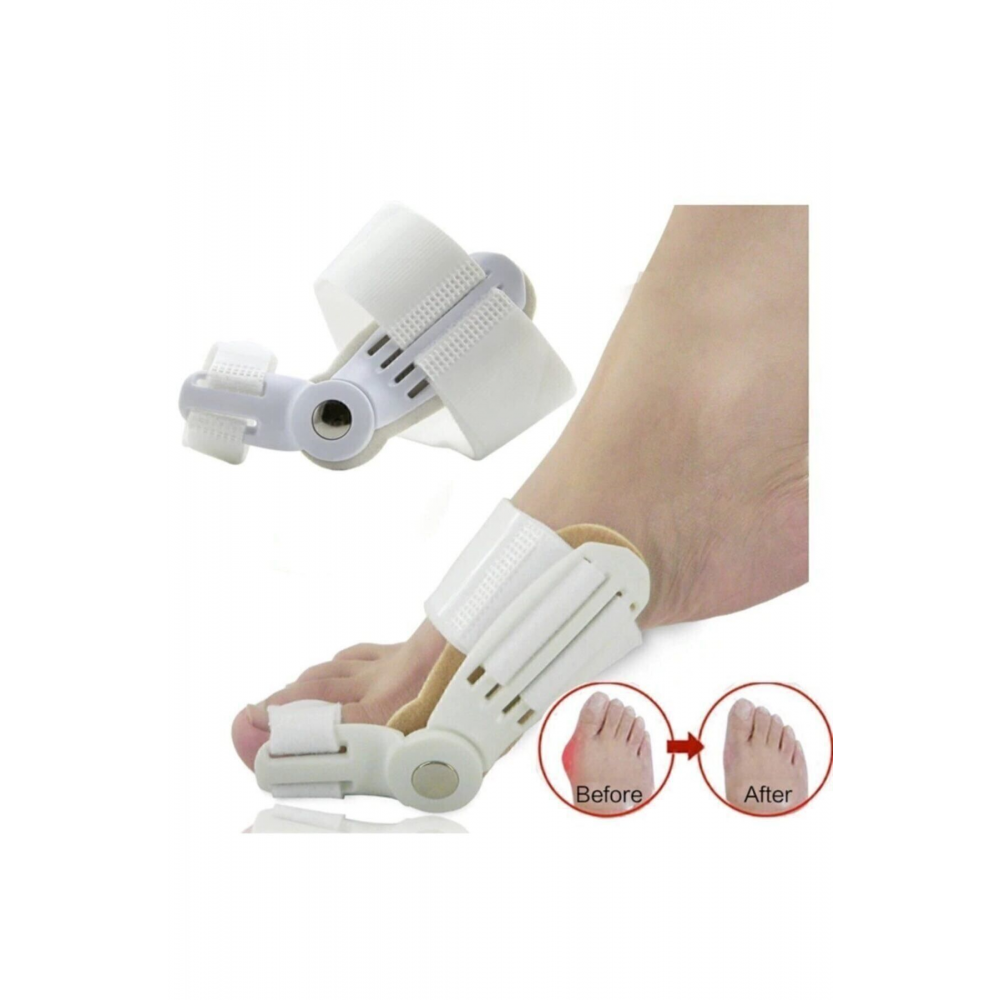 Baş Parmak Kemik Düzeltici - Ayak Parmak Düzeltici
